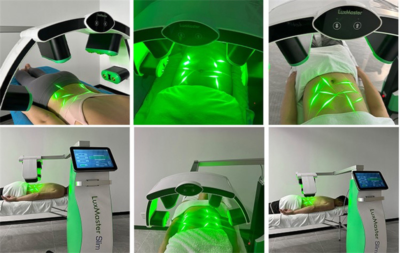 Body Shaping Fat Reduce Emerald Laser Fda Approval 532nm 10d