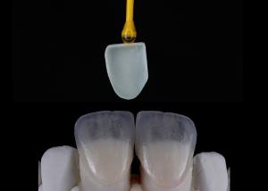 Wholesale Custom Made Dental Restoration EMAX Veneers Beautifully Aligned Digital Impression from china suppliers