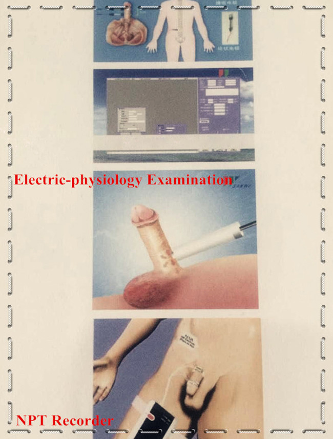 Andrology Test And Treatment Male Sexual Dysfunction Diagnostic NPT
