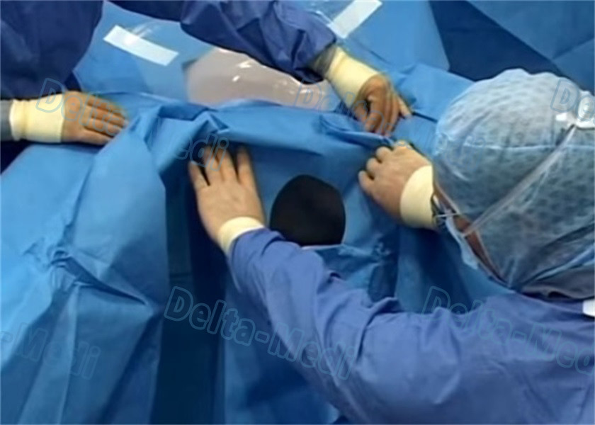 Surgical Laparoscopy Drape , Sterile Disposable Patient Drapes With ETO Blue Color