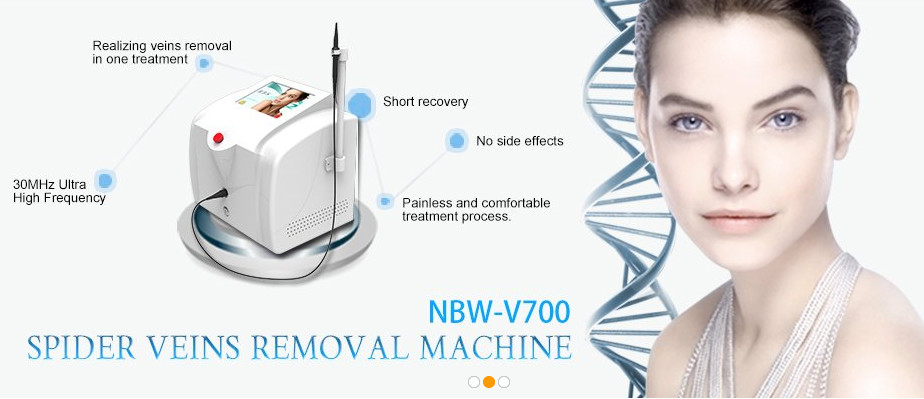 Spider vein laser removal Laser varicose vein removal treatment vascular removal machine