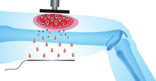 Ret Cet Rf Tecar Therapy Physio Diathermy Pain Relief Machine