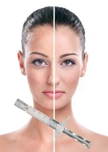 Wholesale Anti Aging Face Lift PCL Skin Booster 2ml Polycaprolactone Hyaluronic Acid from china suppliers