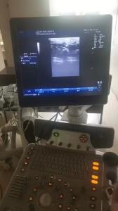 Wholesale GE original imaging ultrasound machine Logiq P6 from china suppliers