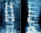 Wholesale High Sharpness Medical X Ray Films from china suppliers