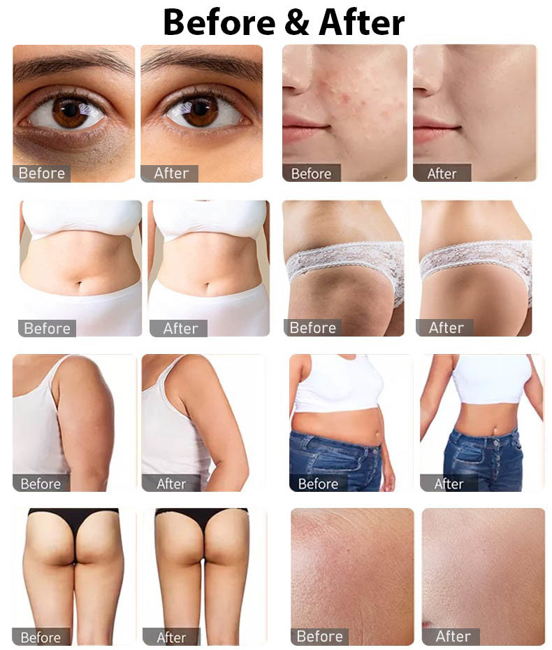 80K Cavitation Slimming Machine Radio Frequency Face Skin Lifting Equipment