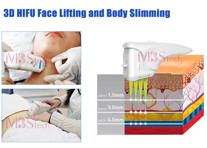 Vaginal Tightening HIFU Facial Machine