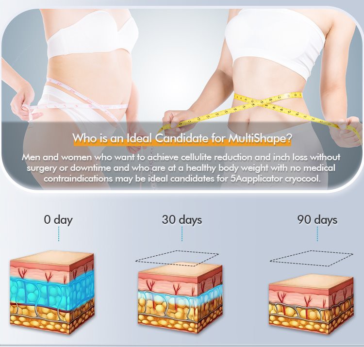 best at home cryolipolysis machine