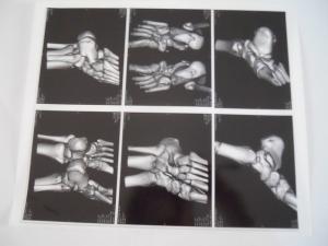 Wholesale Medical Dry Imaging Film For X Ray Examination On AGFA 5300, 5302, 5500 from china suppliers