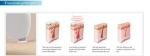 Vertical Beauty Machine Nubway Miracle Epilator 808Nm Despina Lamis 810Nm Diode