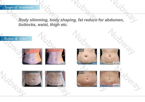 Most and Best popular HIFUSHAPE Slimming Machine in the world