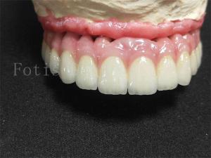 Wholesale Titanium / Zirconia Implant Crown Polished Finish Artificial Dental Crown from china suppliers