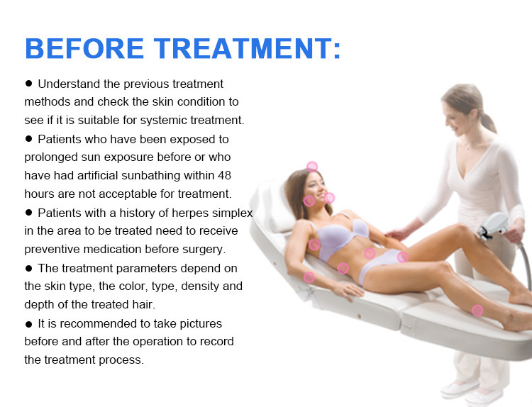 Vertical Q Switched Tattoo Removal Picosure Picosecond Nd Yag Laser Machine