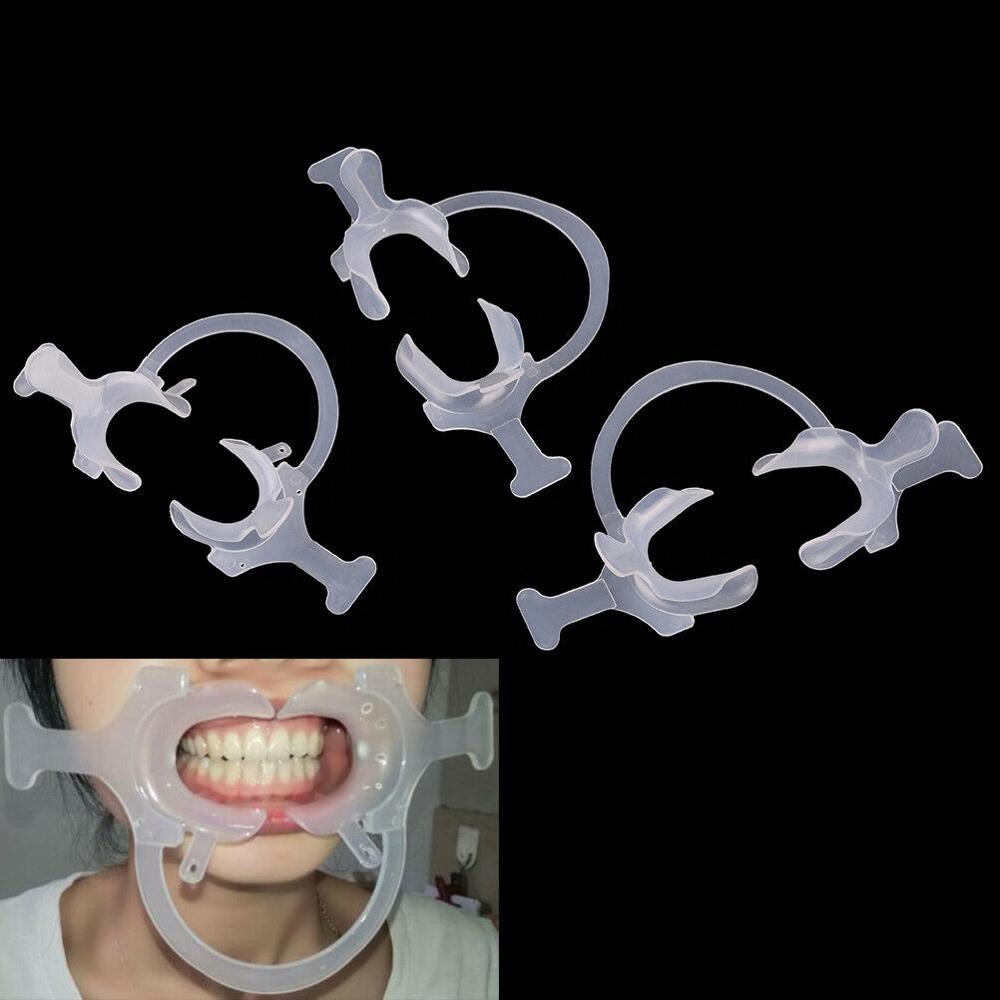 Plastic C Shape Disposable Dental Cheek Retractor Mouth Opener The Game-Changer for Medium/Large Orthodontic Procedures