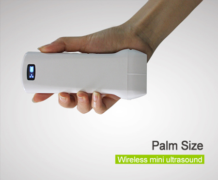 Sonostar Portable Wireless BW Linear PICC Ultrasound Probe For Biopsy Guide