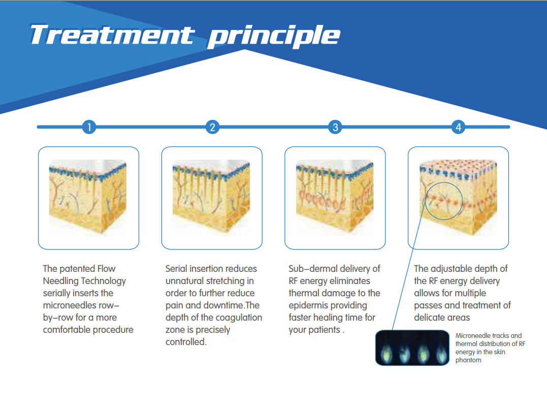 Skin maintenance micro needle nurse system secret microneedle fractional intracel rf micro needling