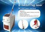 Professional Laser Tattoo Removal Machine