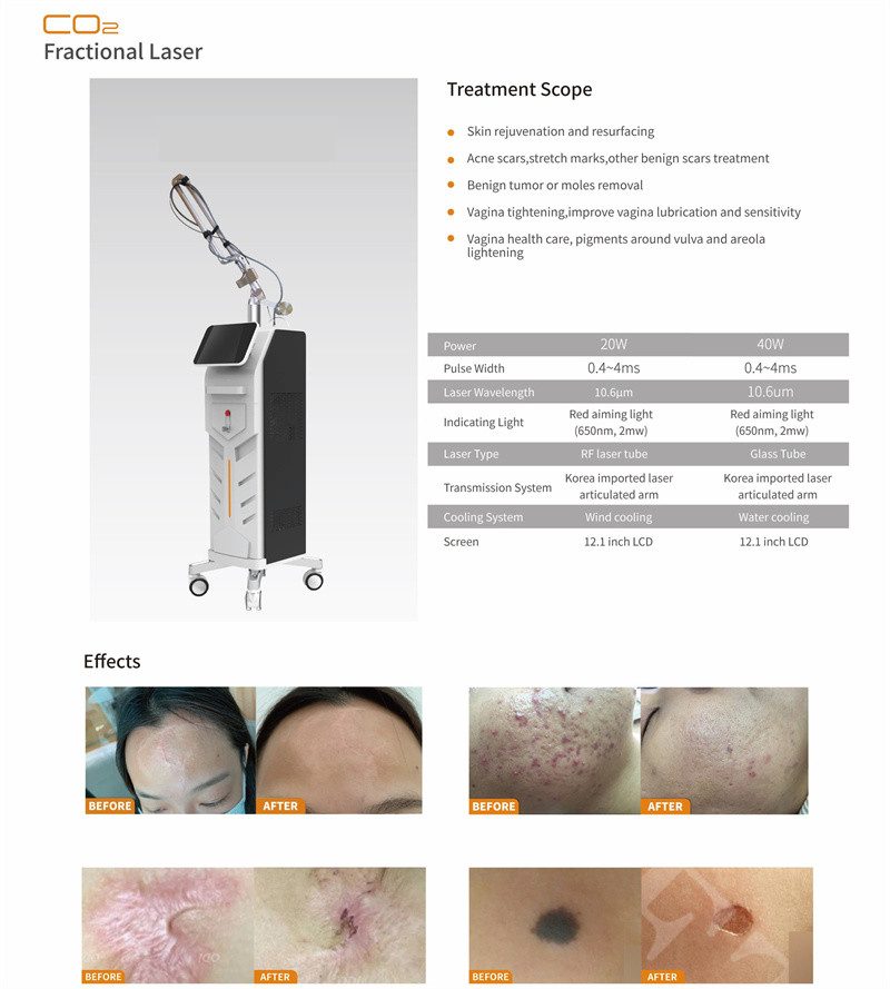 5MJ Fractional Co2 Laser Machine Wrinkle Removal Acne Removal