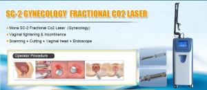 Wholesale 10600nm Fractional CO2 medical Laser of dermatology doctor used for scar removal from china suppliers