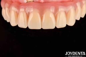 Wholesale Dental Treatment High Elasticity Acrylic False Teeth Finish For Tooth Arrangement from china suppliers