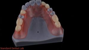 Wholesale 3D Print Model High Esthetics Dental TCS Valplast Flexible Partial Dentures Dental Lab from china suppliers