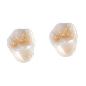 Wholesale All-Ceramic FDA 3014652903 Zirconia Dental Crown Veneer Inlay Onlay from china suppliers