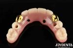 50ml Dentwre From United States Your Ultimate Solution Ti-Bar Acrylic Teeth