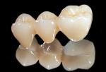 All Ceramic Zirconia Dental Crown