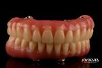 Lightweight Comfortable Fit Acrylic Dental Denture Finish Professional