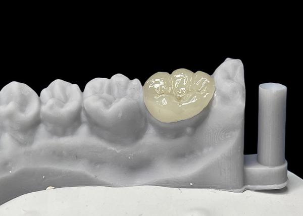 Accurate Fit Dental Ceramic Inlays Onlays , Porcelain Inlays And Onlays FDA