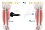 Focus Shockwave Softwave Shock Therapy Tissue Regeneration Machine