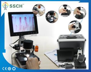 China CE Approved LCD Screen Medical Microscope Capillary Microcirculation on sale