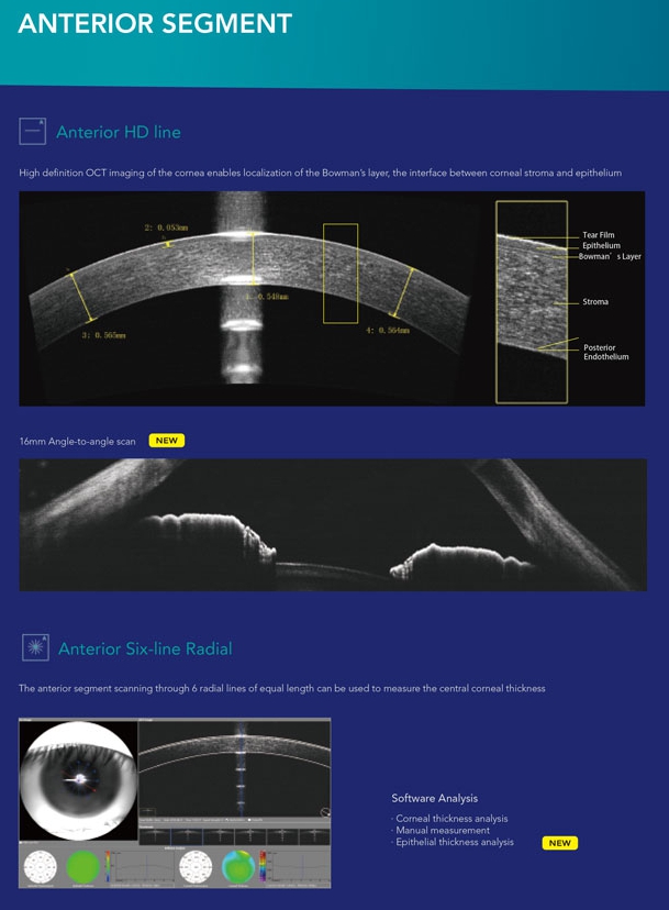 factory price hot selling Advanced OCT Ophthalmic OCT Optical Coherence Tomography