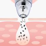 53kPa 3W Facial Vacuum Suction Machine Pore Cleanser Machine Replaceable Head