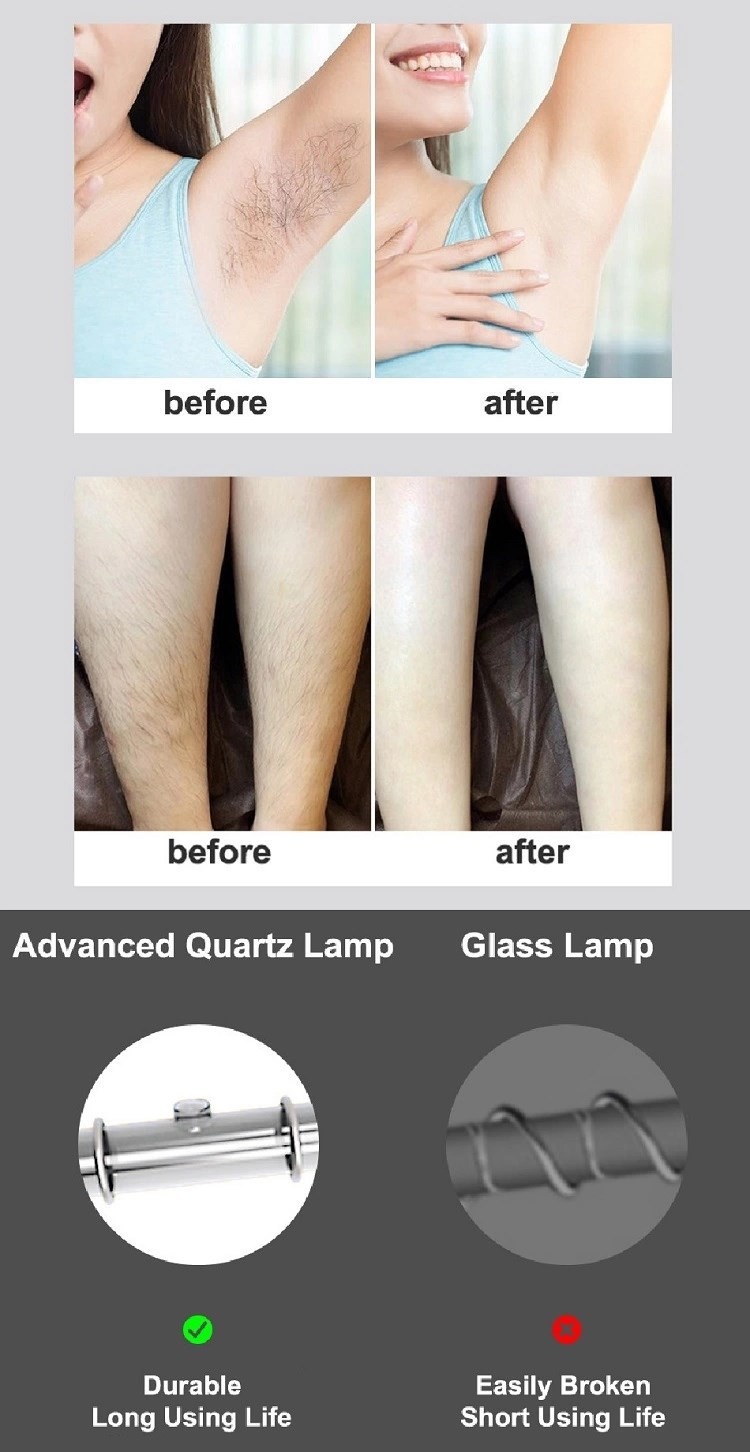 250g 4.2Cm2 100V 240V full body IPL Hair Removal Machine
