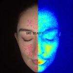 Beauty Spa Face Analyzer Machine Fast Detective 5 Spectra Skin Analysis