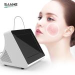 Professional 30W Spider Vein Removal 980nm Diode Laser Vascular Laser Machine