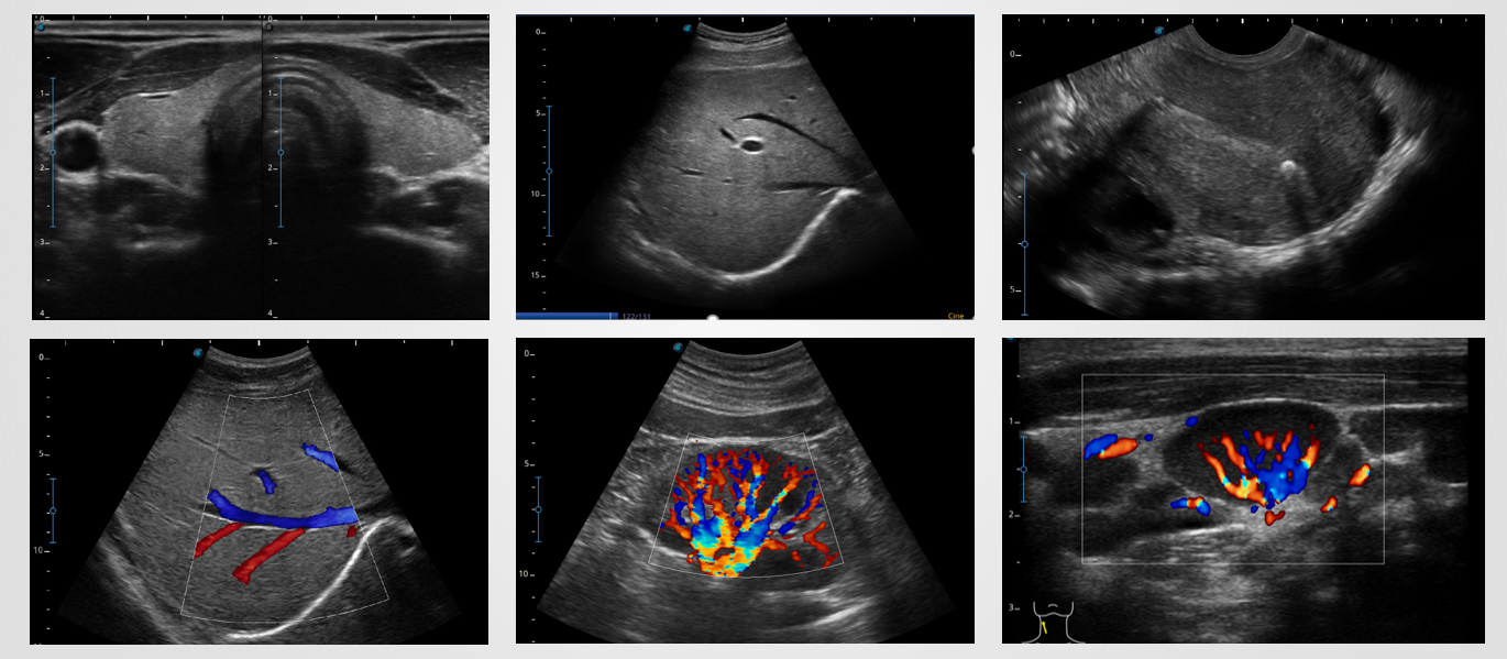 Sonoscape X5 Medical Ultrasound Instruments Machine with Excellent Image Quality