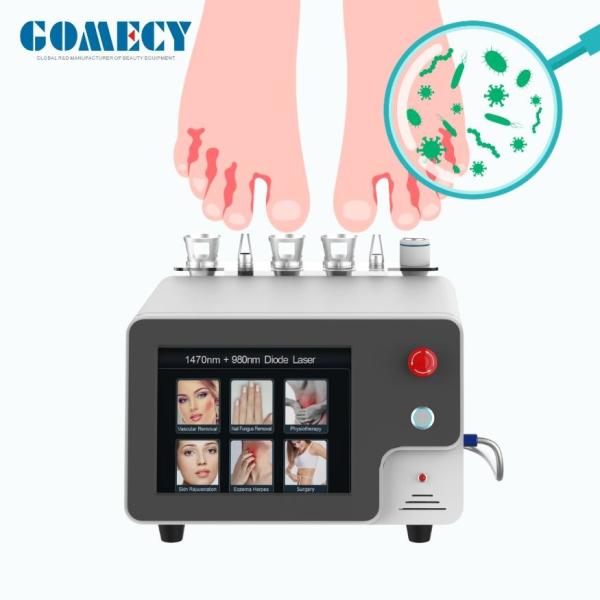 Multifunctional Physical Therapy And Body Beauty Device 980nm 1470nm Laser