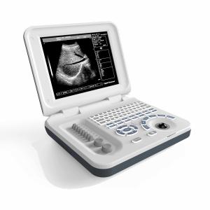 Wholesale Multipurpose Equine Vet Portable Ultrasound Machine DRF RDA from china suppliers