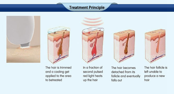 CE approval most professional high quality top selling 600W diode laser hair removal machine