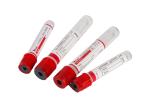 Pain Red Top Blood Tube No Additive Blood Collection Tubes Bd No Additive Tube