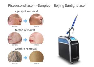 Wholesale Vertical Picosecond Laser Tattoo Removal Machine Pigmentation Removal Acne Treatment from china suppliers