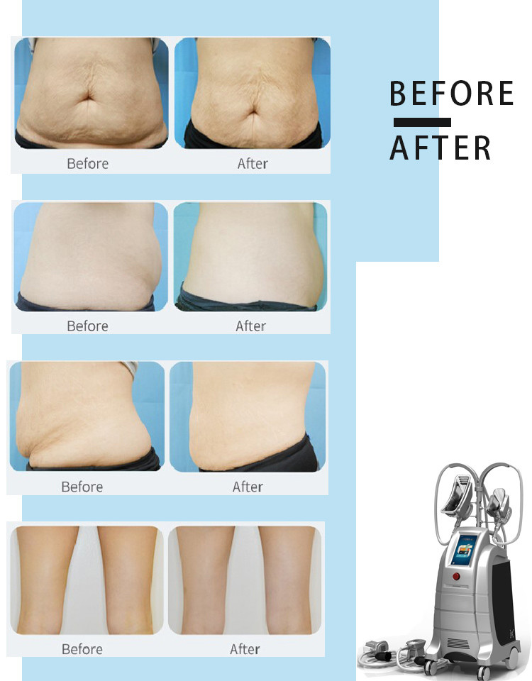 HOTTEST 4 handpiece professional Cryolipolysis Machine, Cryolipolysis Slimming Machine, Cryolipolysis Fat Freezing Machi