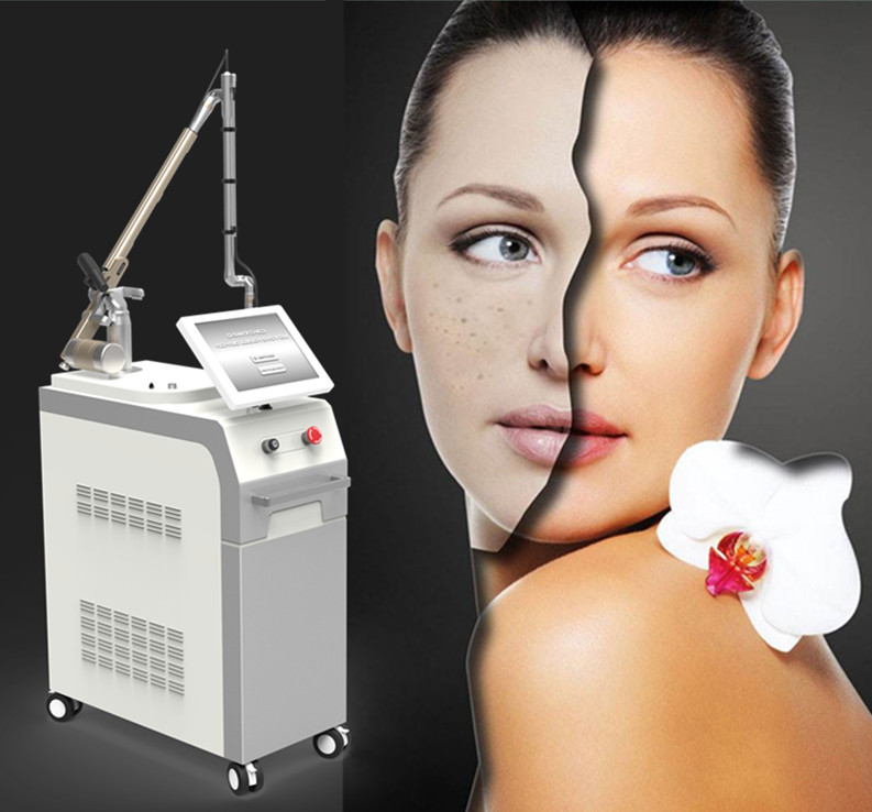 1064nm and 532nm all kinds of tattoo removal cost q switch laser