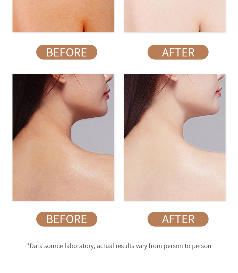 Skin Care Products L Glutathione Skin Whitening Body Lotion Brightening Body Lotion Hydrating Vitamin