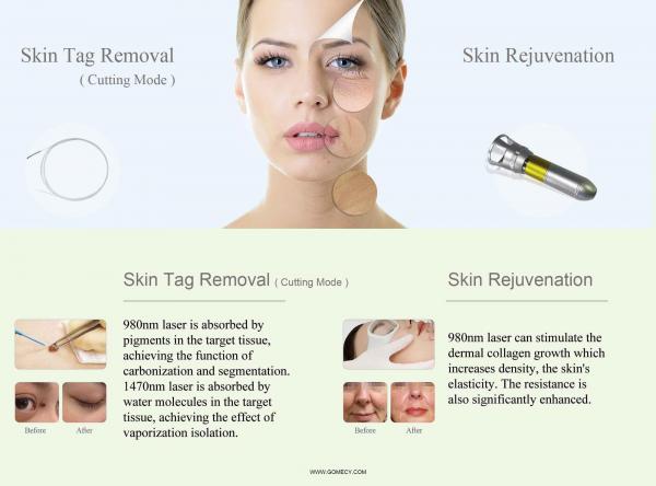 face skin rejuvenation
