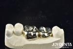 Wax Casting Dental Repair Full Metal Crown For Abrasion Resistant Oral