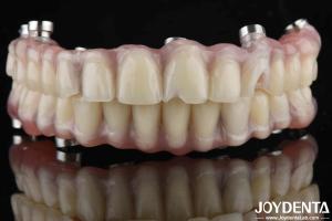 Wholesale Natural Look Dental Laboratory Acrylic Teeth Finish For High Wear Resistance from china suppliers