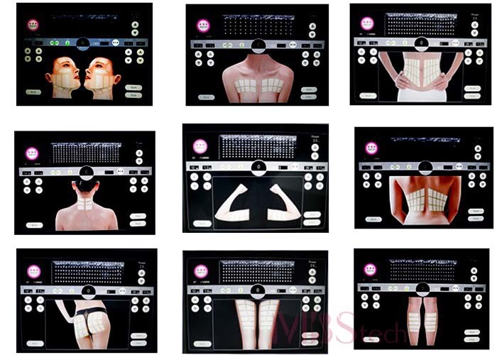 3d 11 Lines Anti Wrinkle Ultrasound Facelift HIFU Facial Machine